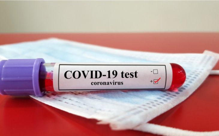 Azərbaycanda daha 2 nəfər koronavirusa yoluxub, ölən olmayıb