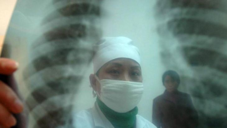 Ağciyər Xəstəlikləri İnstitutunda iki ölüm hadisəsi baş verib - Eksklüziv
