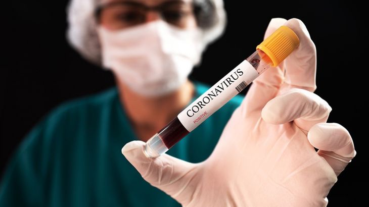 Azərbaycanda daha 113 nəfər koronavirusa yoluxub, 40 nəfər sağalıb, bir nəfər ölüb
