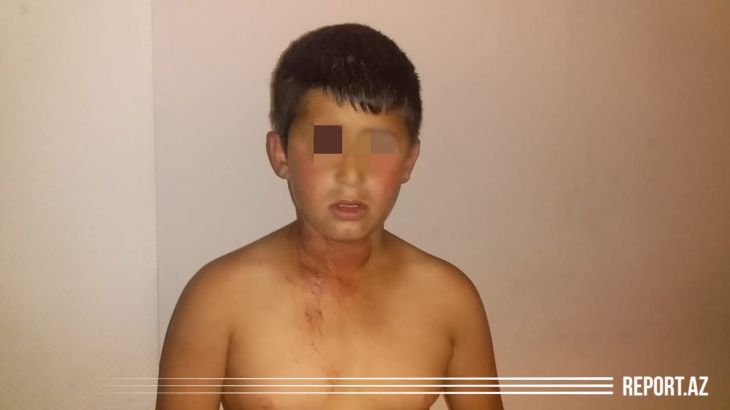 Ata dilənmək istəməyən 11 yaşlı oğlunu başından bıçaqladı - FOTO