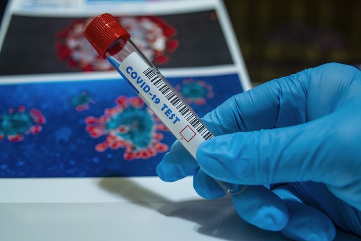 Azərbaycanda daha 257 nəfər koronavirusa yoluxub, 202 nəfər sağalıb