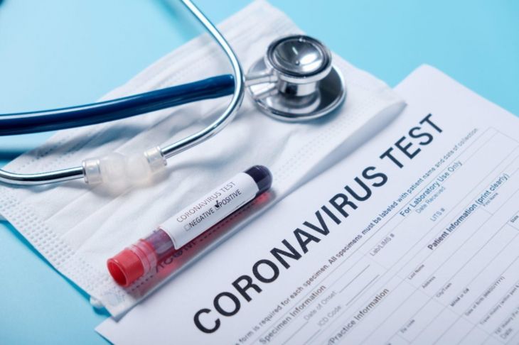 Koronavirus testlərinin cavablarının gecikməsi ilə bağlı RƏSMİ AÇIQLAMA