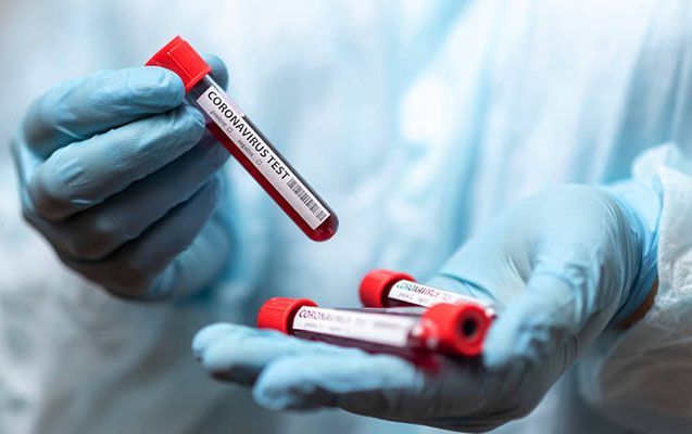 Azərbaycanda daha 2406 nəfər koronavirusa yoluxub, 37 nəfər ölüb